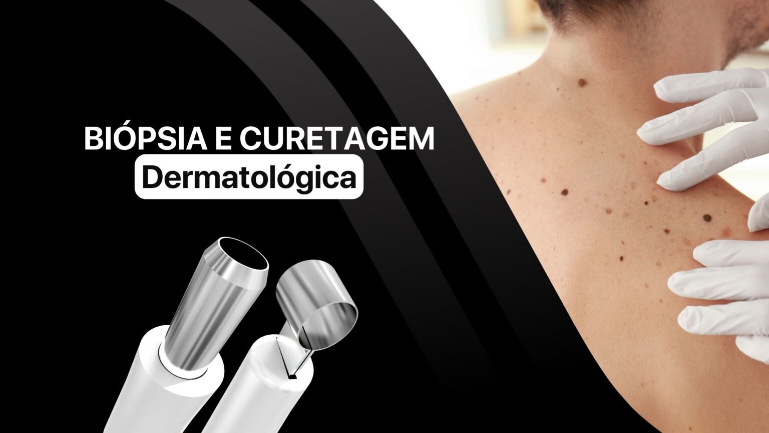 BIÓPSIA E CURETAGEM DERMATOLÓGICA